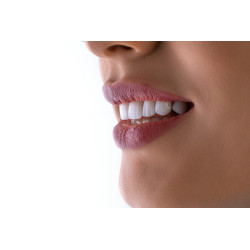 Albire dentară profesională