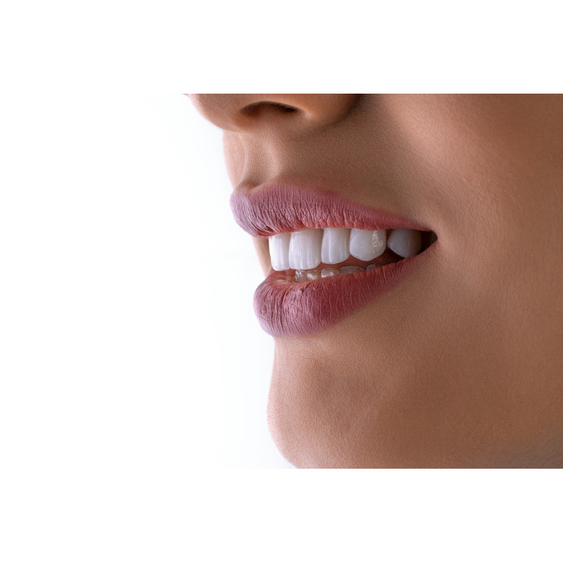 Albire dentară profesională